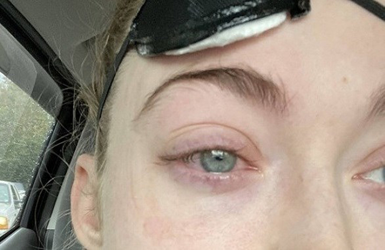 عدسات تمزق عين فنانة مكياج