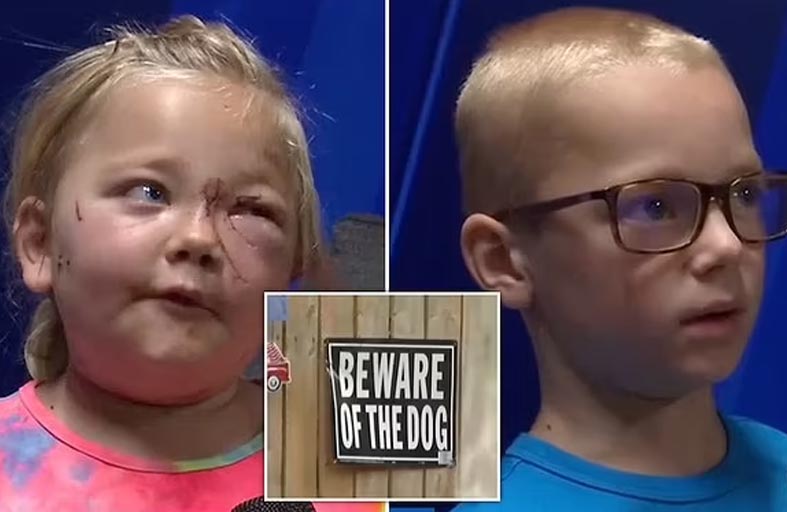 طفل شجاع ينقذ شقيقته من أنياب كلب 