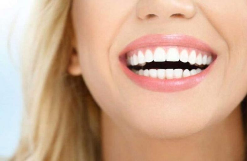 شرب الماء بعد الوجبات يساعد على تبييض الأسنان