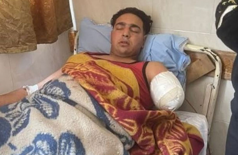 النمر التهم ذراعه.. تفاصيل «الهجوم المرعب» في مصر