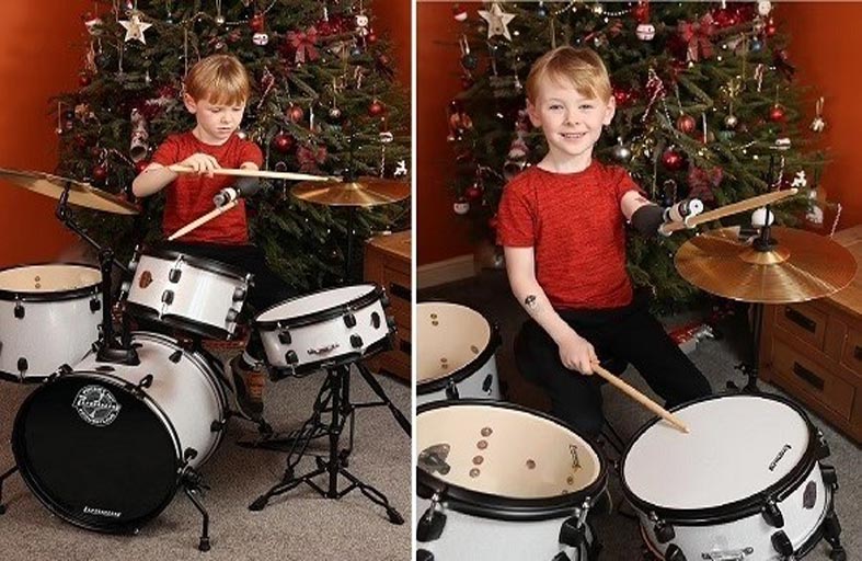 طفل يعزف بذراع روبوتية