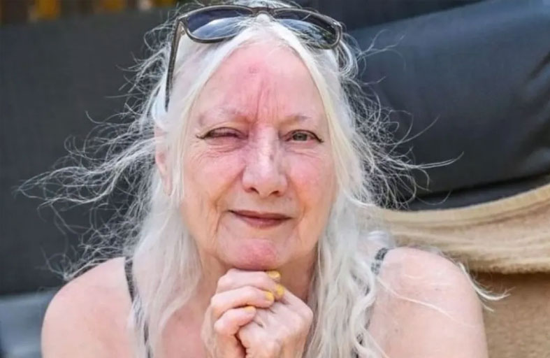 قيلولة لمدة 15 دقيقة تشوّه وجه سيدة بريطانية