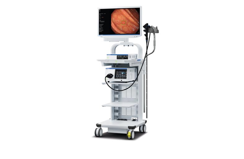 ميديكلينيك مستشفى بارك فيو تقدم أول جهاز في الشرق الأوسط يستخدم الذكاء الاصطناعي للمساعدة في الكشف عن العلامات المحتملة لسرطان القولون وسرطان الجهاز الهضمي