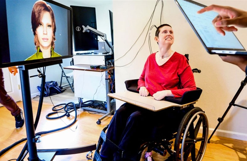 غرسة آلية تحول أفكار امرأة إلى كلام بعد صمت 18 عاماً