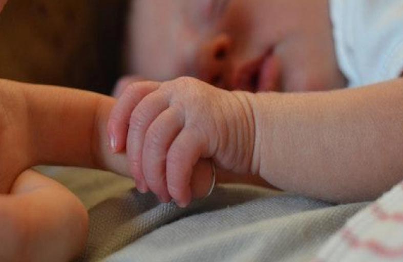 ولادة طفل يحمل شقيقه التوأم داخل بطنه