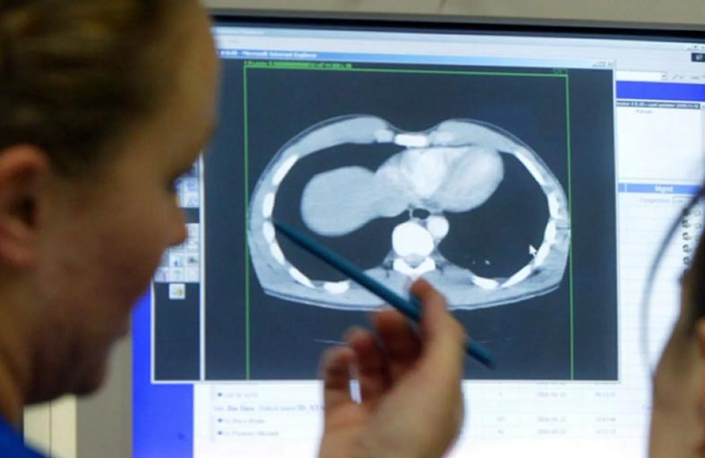 آكلة الدماغ.. أكثر الطفيليات فتكاً    