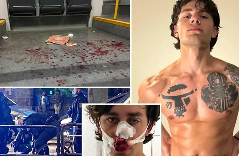 يشوهان وجه عارض أزياء أثناء دفاعه عن سيدتين