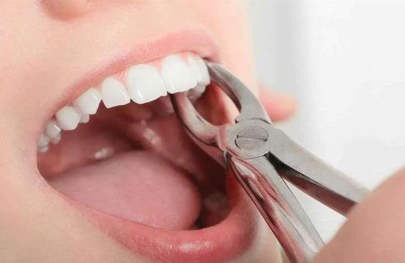 «خلع ضرس» يقود سيدة إلى نهاية مأساوية