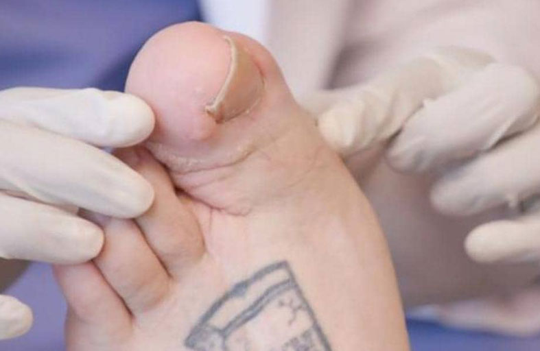 اضطراب حول حياة شاب إلى مأساة