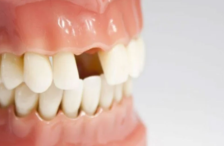 دواء لإنبات أسنان بشرية جديدة