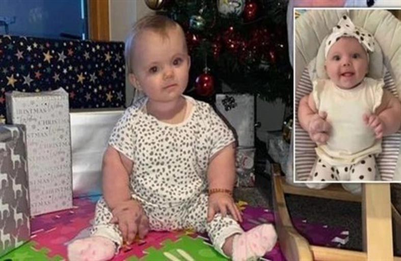 أم تكشف معاناة رضيعتها من متلازمة الفيل