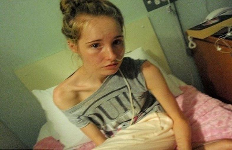 تتحدى الموت بعدما انخفض وزنها إلى 28 كغ