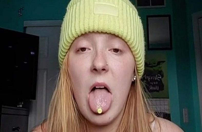 ينمو الشعر في لسانها بسبب حالة نادرة