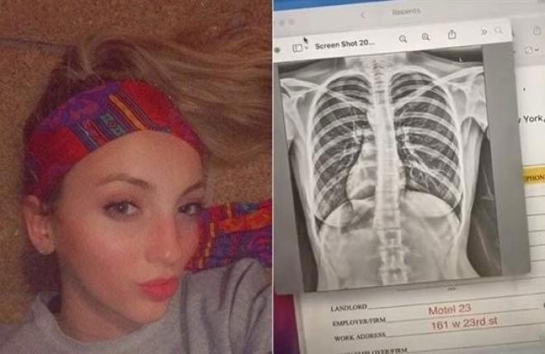 فتاة تكتشف أن قلبها في مكان غير مكانه 