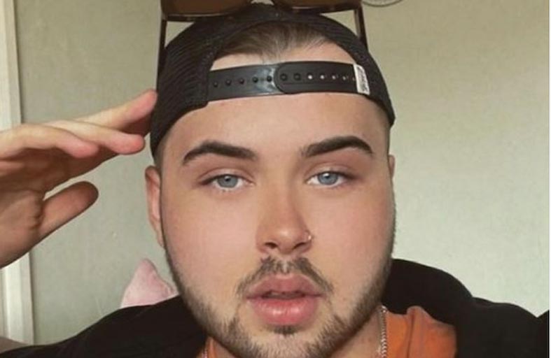 يصاب بسرطان الجلد لشغفه بتسمير نفسه