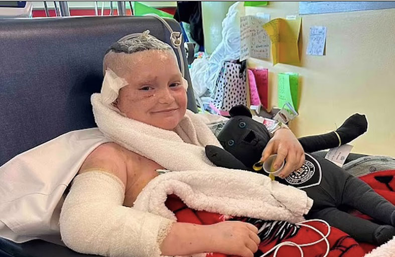 مزقت الكلاب 70 % من فروة رأسه