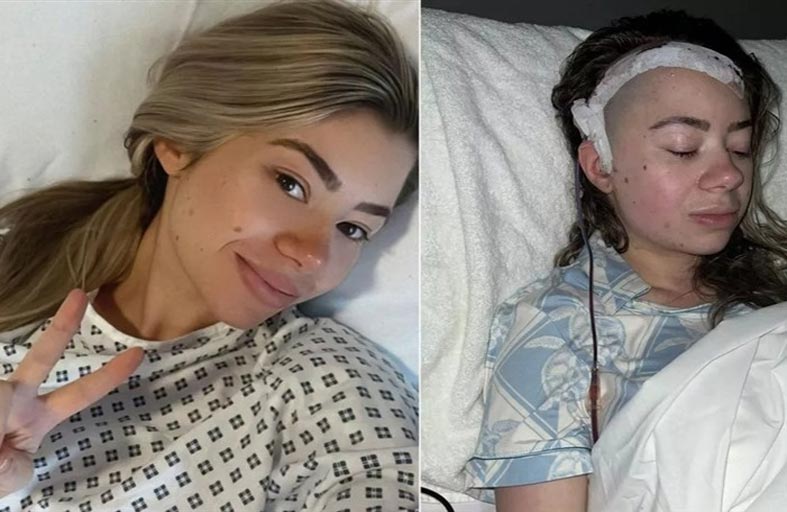 تشخيص خطأ يصيب امرأة حاملاً بالعمى