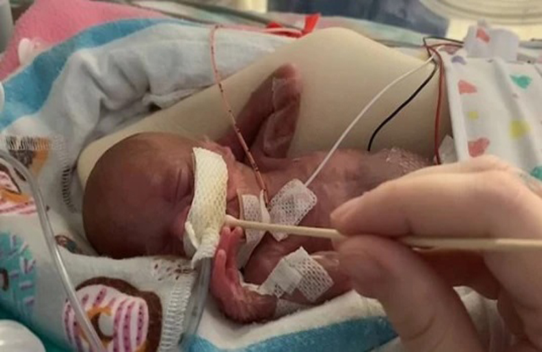 طفلة تتحدى التوقعات بعدما ولدت بوزن 700 غرام