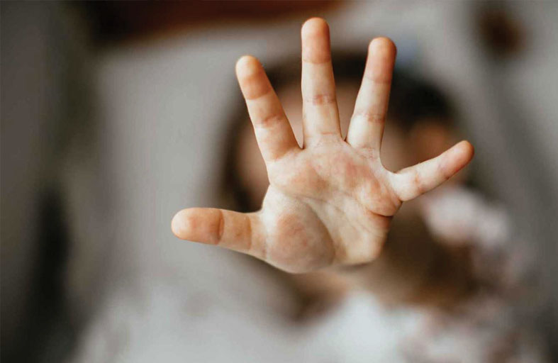 أم بالتبني متهمة بإساءة مروعة لطفل معاق