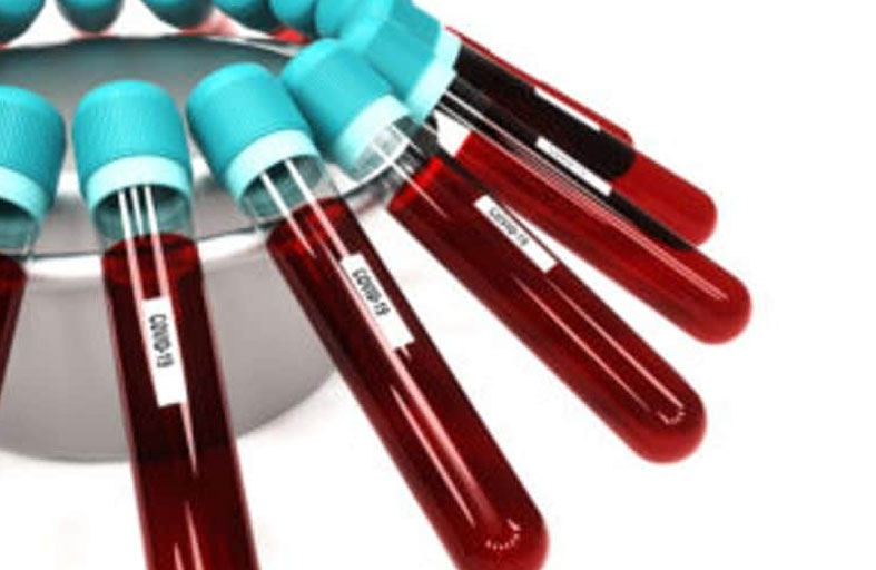 اختبار دم يكتشف السلوك الانتحاري