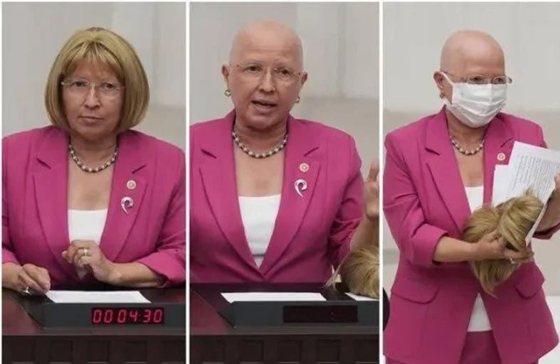 نائبة تخلع شعرها المستعار في البرلمان 