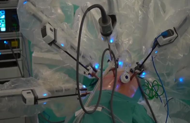 أطباء ينجحون بزراعة رئة بتقنية رائدة