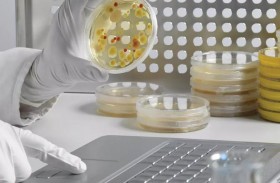 دراسة: الكيبورد أكثر قذارة من مقاعد المرحاض