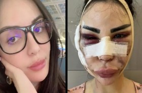 حاولت أن تصبح مثل كيم كارداشيان.. ثمّ ندمت