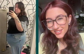 أنفقت الآلاف على عملية تكميم .. فأصيبت بمرض مميت