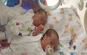 شفاء توأم أصيبتا بكورونا داخل الرحم