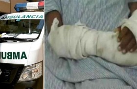 تحرق يد طفلتها بسبب الحلوى