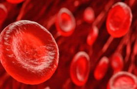 طريقة لإزالة الرواسب الخطرة من جدران الأوعية الدموية