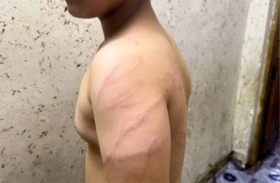 مدرسون يضربون طالباً بسلك كهرباء