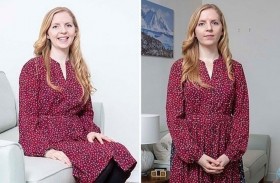 تشفى من الصداع بالوخز بالإبر