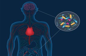 اكتشاف رابط غريب بين بكتيريا الأمعاء والتدهور المعرفي لمرضى باركنسون