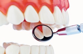 علماء يختبرون دواء جديدا لعلاج التهاب اللثة