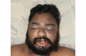 شرطة دبي تدعو الجمهور للتعرف على صاحب جثة مجهولة