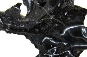 دماغ شاب تحول إلى زجاج.. اكتشاف نادر يُذهل العلماء!