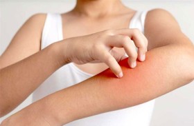 الأطعمة الأكثر تسببا للحساسية وسبب ردود الفعل تجاهها