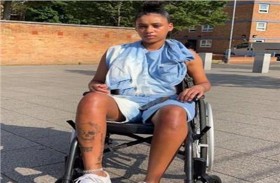 تصاب بالشلل من غاز الضحك 