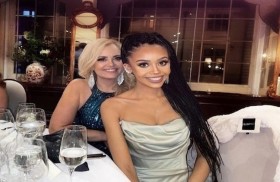 تخضع لجراحة تجميلية في فكها بسبب تعليق من أفراد عائلتها