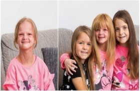 طفلة تتبرع بشعرها