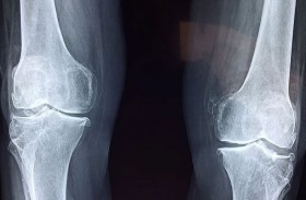 دراسة تفضل رياضة كرة القدم على الجري