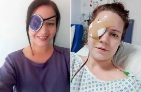 أول شخص يتم تشريح جسده على الهواء