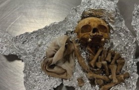 جمجمة وفقرات بشرية في حقيبة سفر