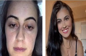 تخضع لـ 200 عملية بعدما ولدت بنصف قلب