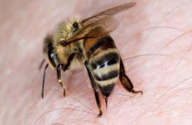 20 ألف لسعة نحل تدخله في غيبوبة