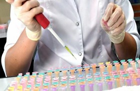 أكبر تجربة لاختبار دم لخمسين نوعا من السرطان