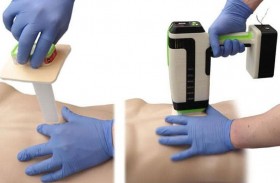 في دقيقة واحدة.. جهاز مبتكر يوقف نزيف الجروح