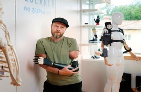 رجل يحصل على أول ذراع آلية بالكامل